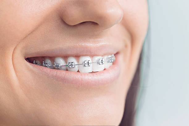 Best Dental Inlays and Onlays  in Elk Grove Vlage, IL